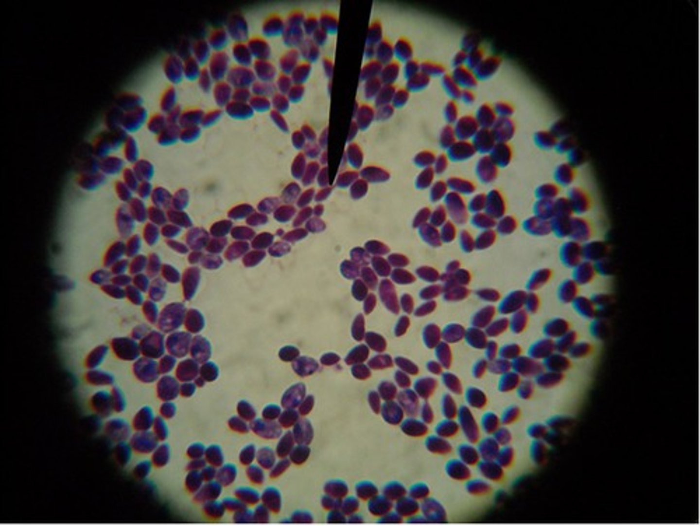<p>Budding yeast (blastoconidia)</p><p>Pseudohyphae (elongated chains of yeast cells)</p>