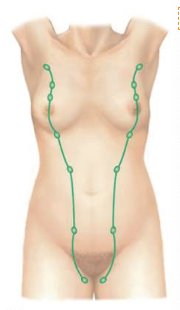 <p>extra nipples </p>
