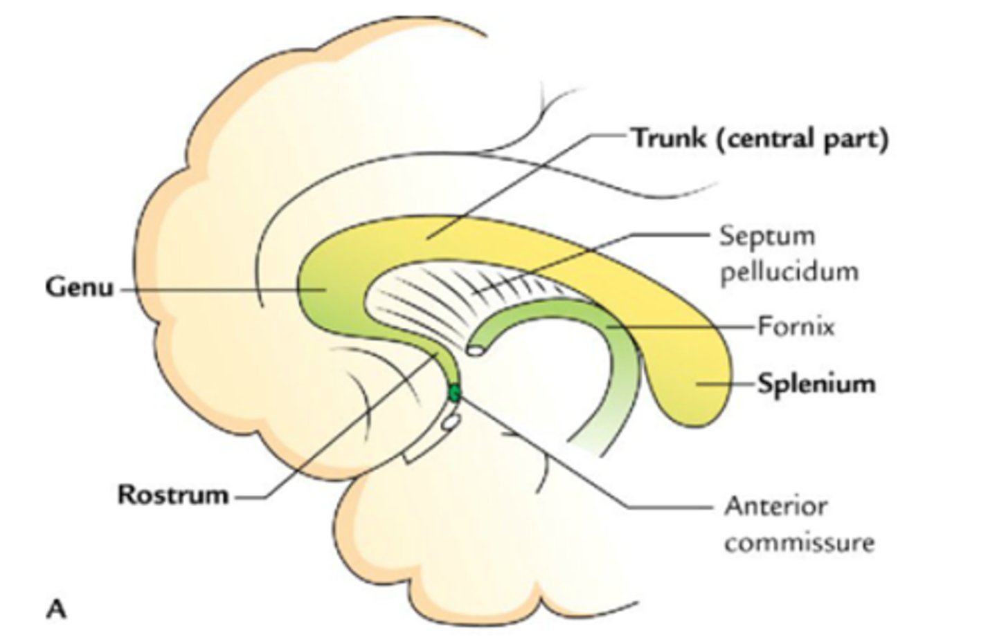 <p>- nad komorą</p><p>- promienistość ciała modzelowatego</p><p>- spoidło to jest pod płatem ciała modzelowatego, łączy prawą i lewą odnogę sklepienia</p><p>- spoidło to jest poniżej dzioba ciała modzelowatego, w ścianie przedniej komory trzeciej</p><p>- pod jądrem </p>