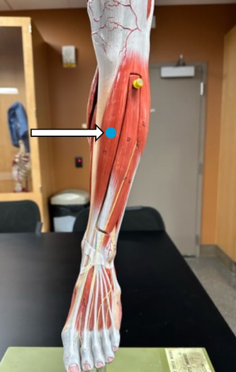 <p>tibialis anterior (function)</p>