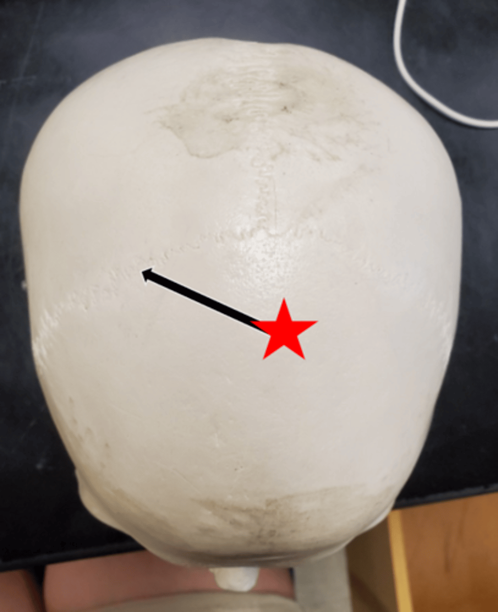 <p>Name the suture the arrow is pointing to in the image.</p>