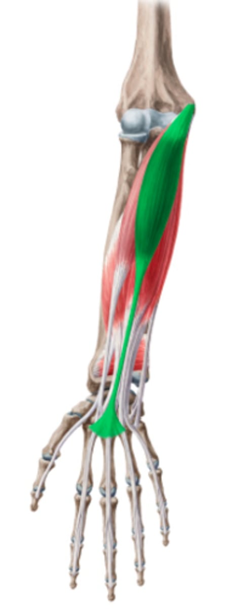 <p>Welke spier is dit?</p>