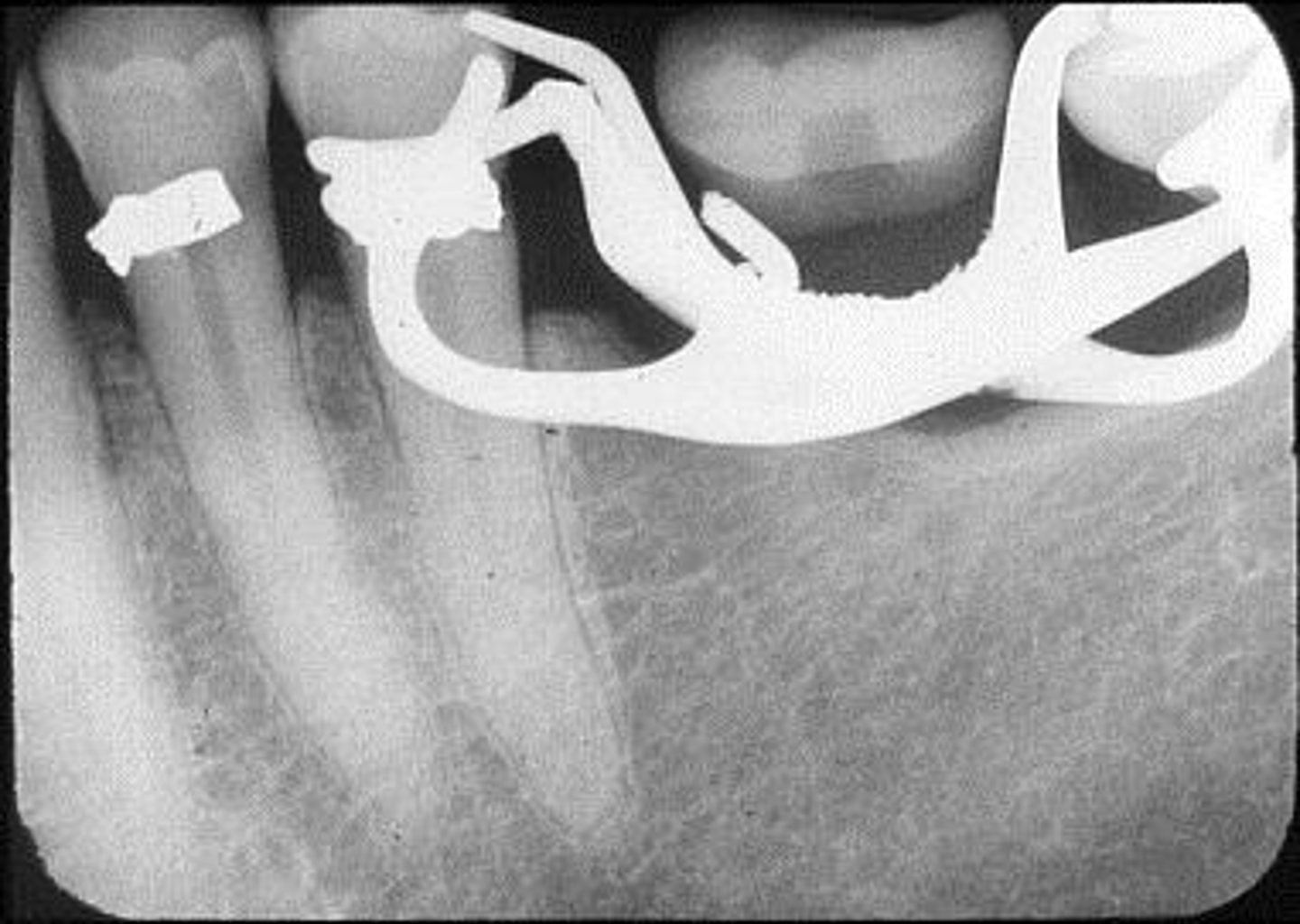 <p>What is this error?</p>