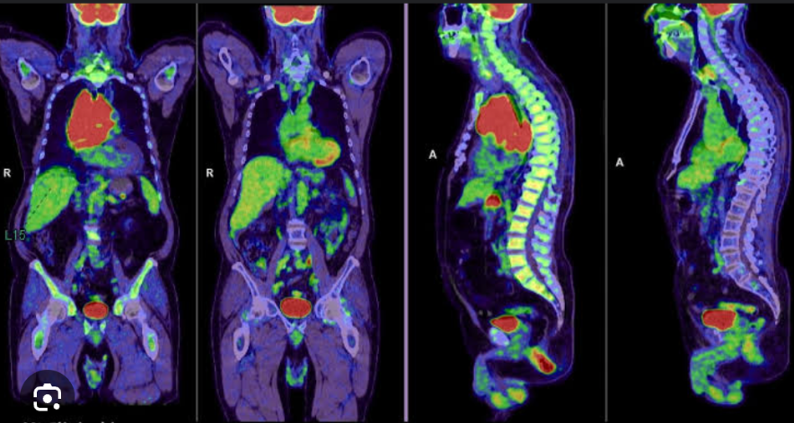 <p>It is an investigational technology that assesses biologic processes at the cellular and subcellular level in living tissue. Areas of interest include the biology of cancer and cardiovascular disease.</p>