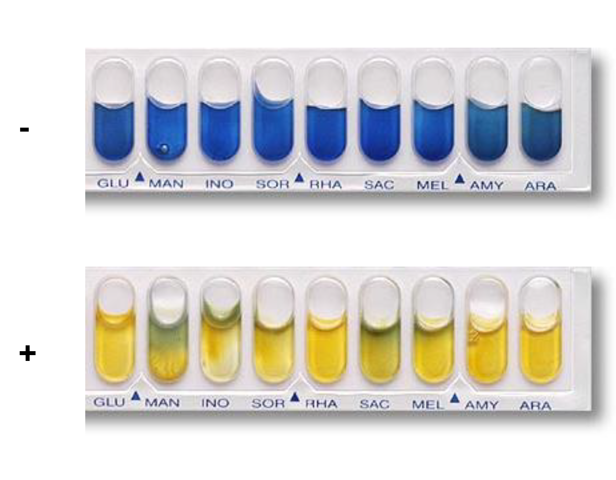<p>To determine whether bacteria can ferment or utilize a specific carbohydrate.</p><p><strong><u>CARBOHYDRATE METABOLISM</u></strong></p><ul><li><p>Cellular Respiration</p><ul><li><p>Key pathways: Glycolysis ,Krebs Cycle, Electron Transport Chain</p></li></ul></li><li><p>Fermentation</p><ul><li><p>Key pathways: Glycolysis, Fermentation</p></li></ul></li></ul><p></p>