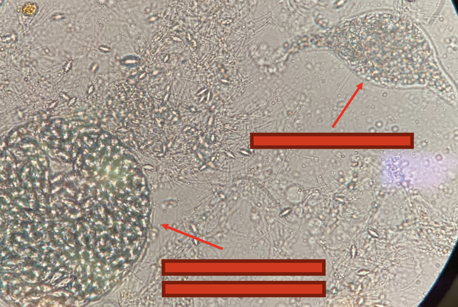<p>What are the arrows pointing at? What structures are they, and what kind of parasite is it?</p>