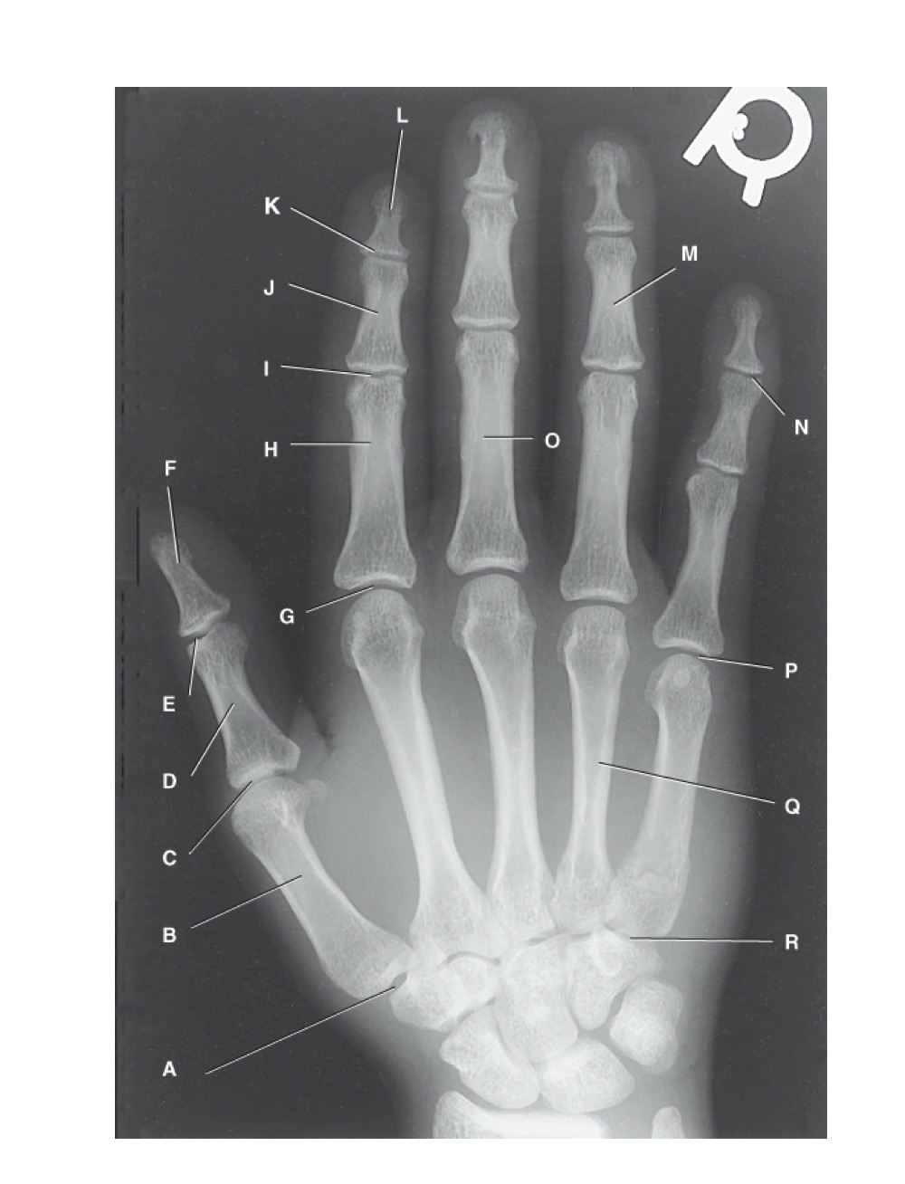 <p>G?</p>