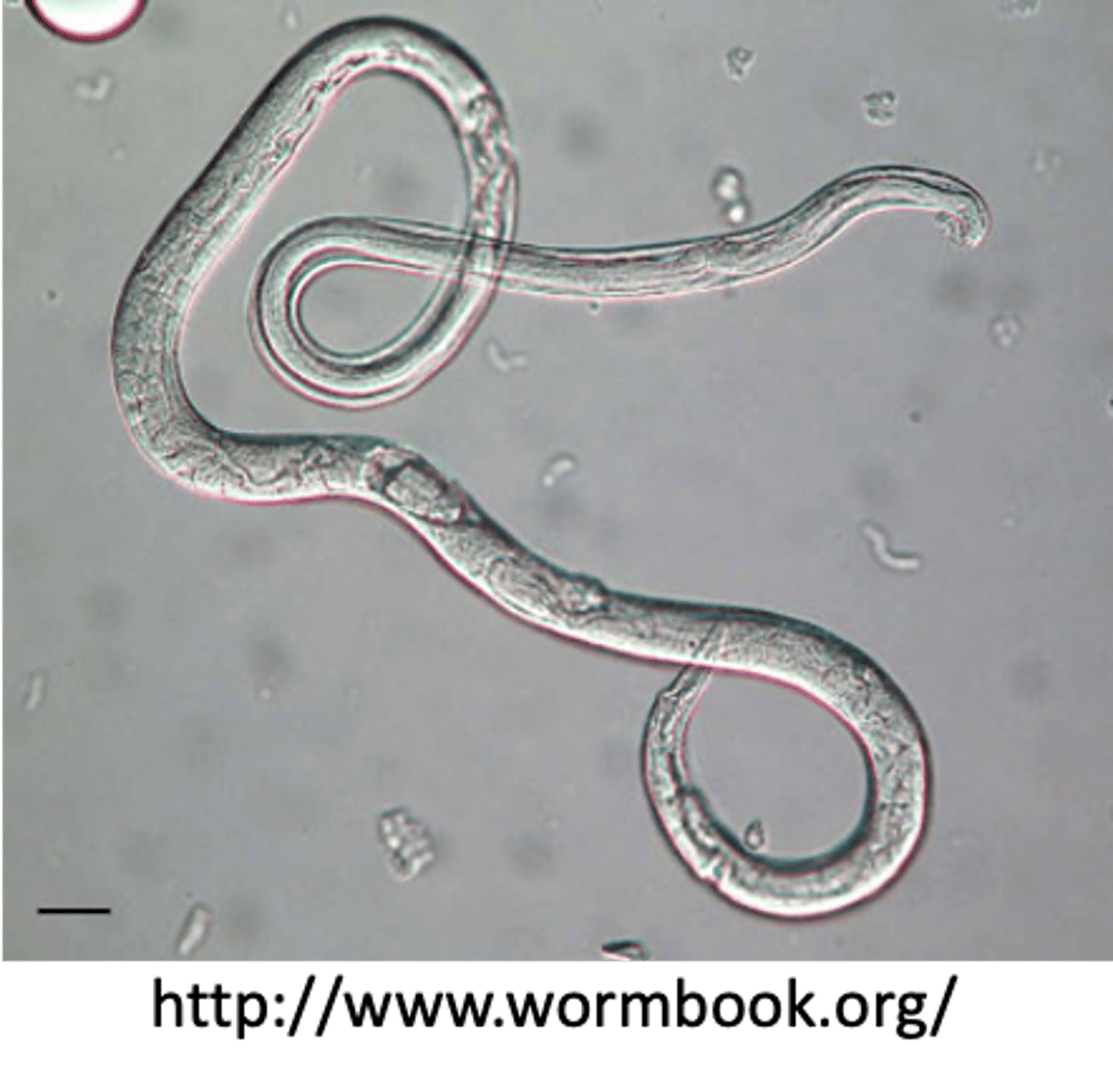 <p>Found in a piglet which died due to emaciation and diarrhoea. What parasite is this?</p>