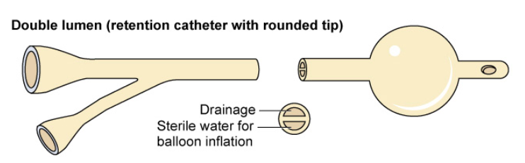 <ul><li><p>double lumen. one inflates, other is for the drainage </p></li><li><p>come in French. smaller the number, the smaller the size</p></li></ul><p>Male: 18-20 Fr </p><p>Female: 14-16 Fr</p>