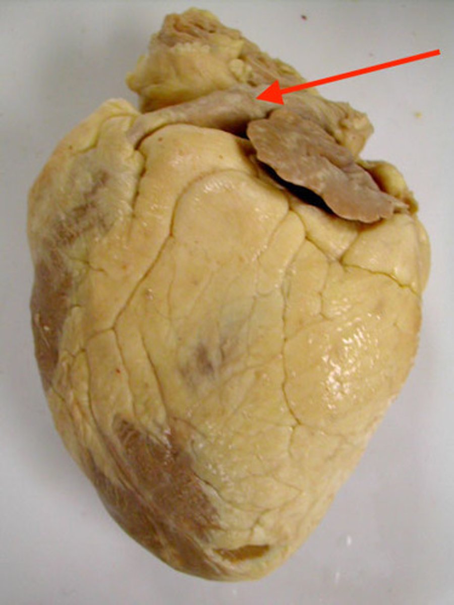 <p>Identify the blood vessel that carries blood from the right ventricle to the lungs</p>
