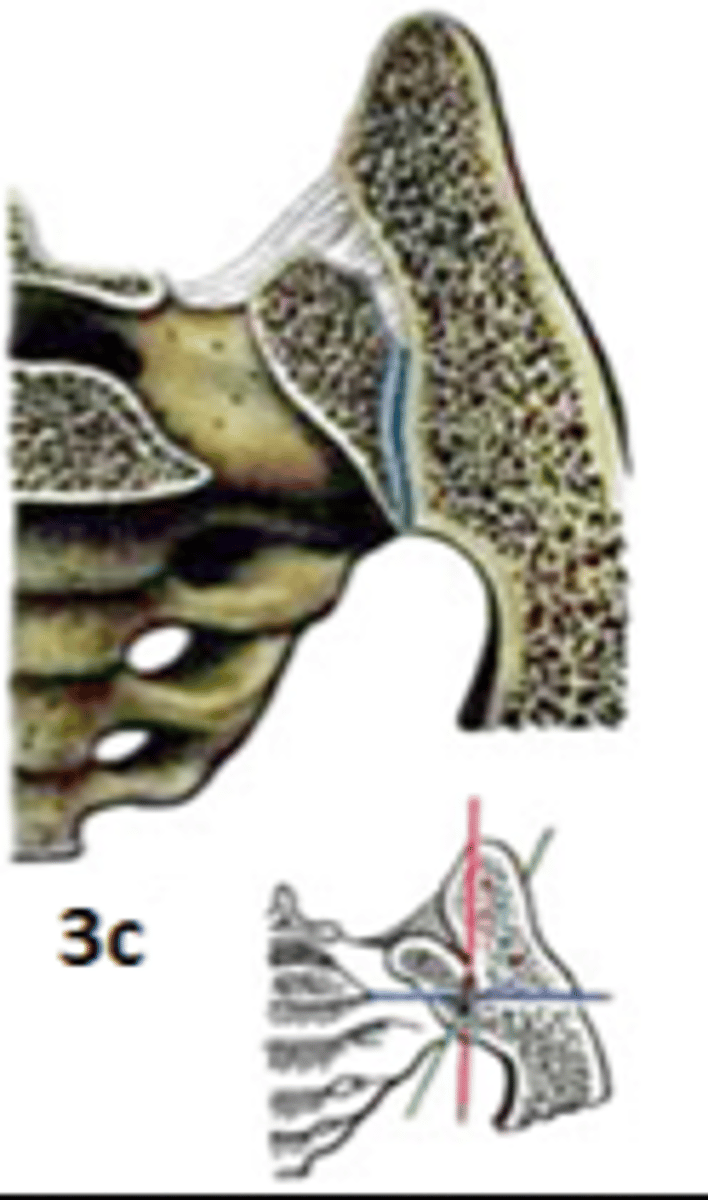 <p><strong><em>plakanā locītava (amphiarthrosis- mazkustīga)</em></strong></p>