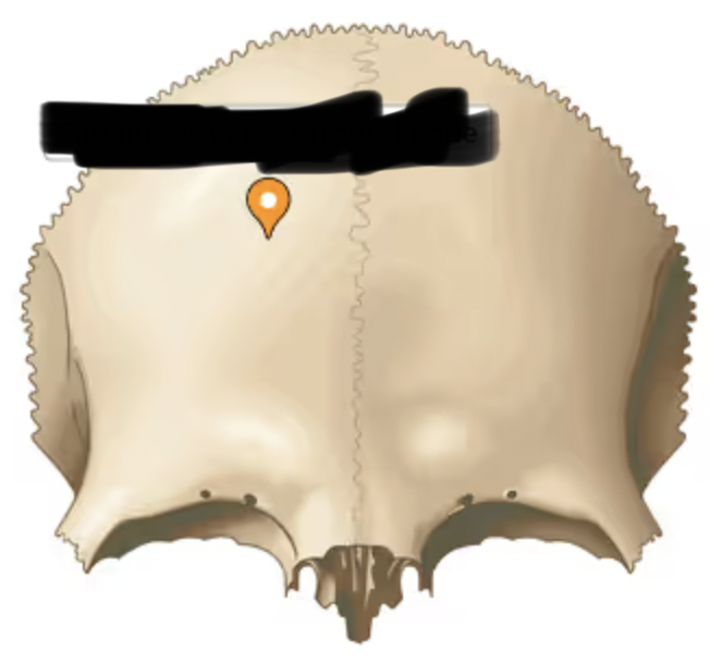 <p>(scale-like)- large, rounded superior part of bone above orbits</p>