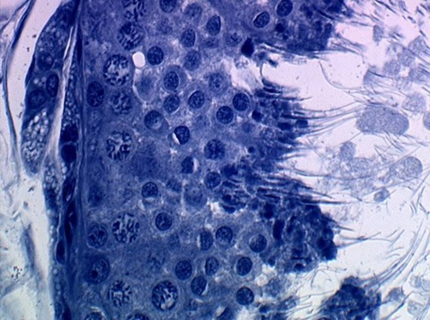 <p>Mature sperm cells released into the tubule.</p>