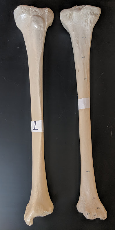 <p>Name this bone</p>