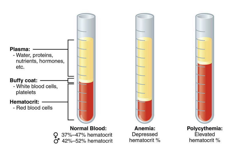 <p>Polycythemia <span data-name="drop_of_blood" data-type="emoji">🩸</span><span data-name="chart_increasing" data-type="emoji">📈</span></p>