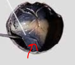 <p>What part of the eye is this</p>