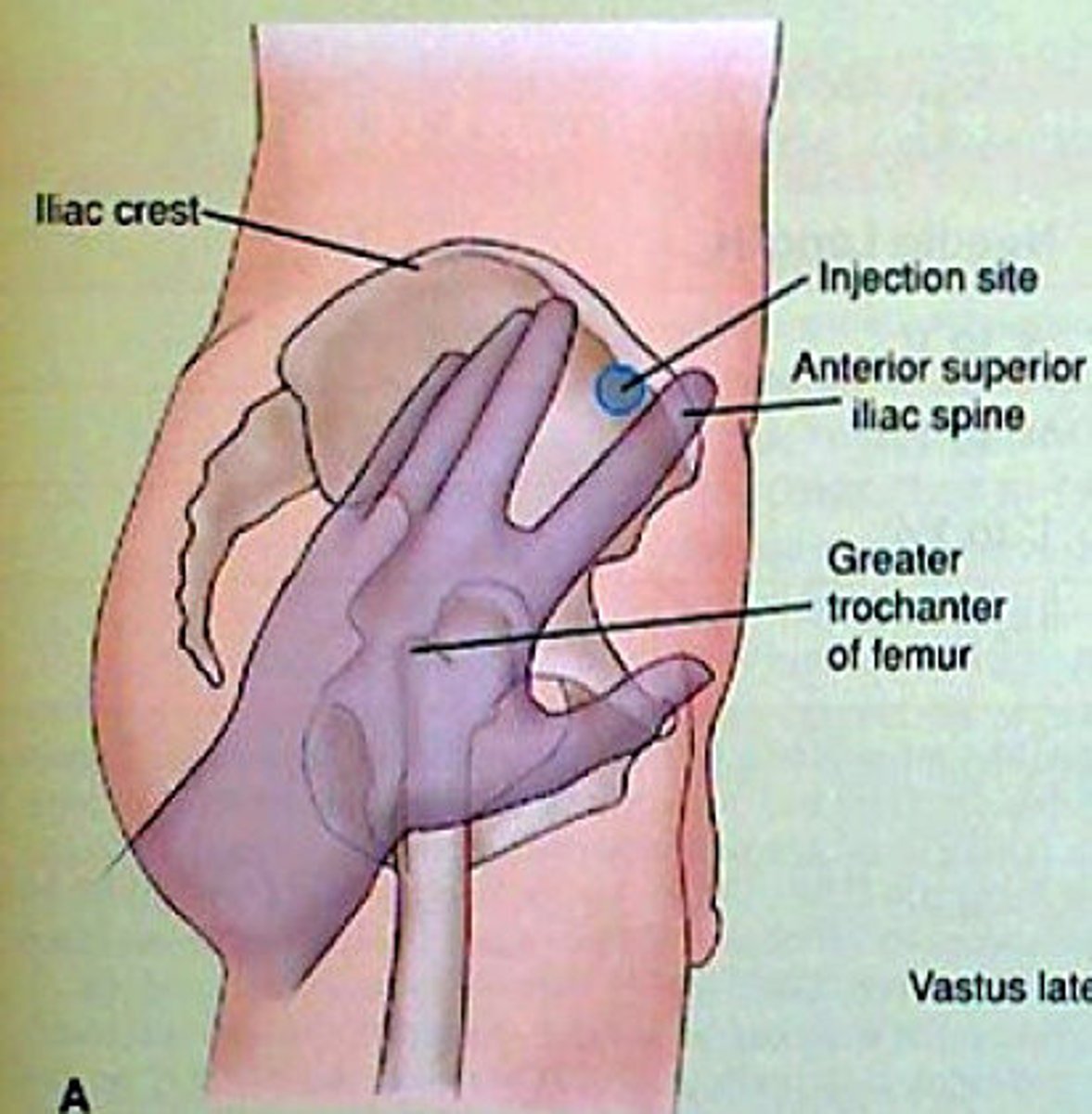 <p>intramuscular</p>