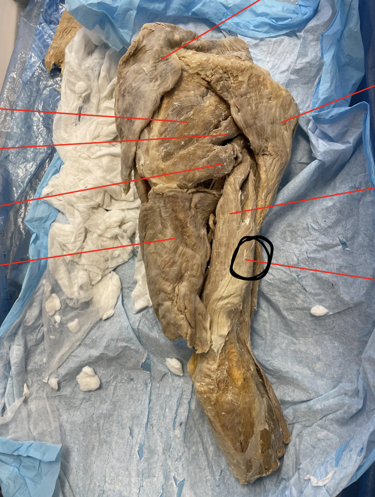 <p>identify + state origin, insertion, action, innervation of marked structure</p>