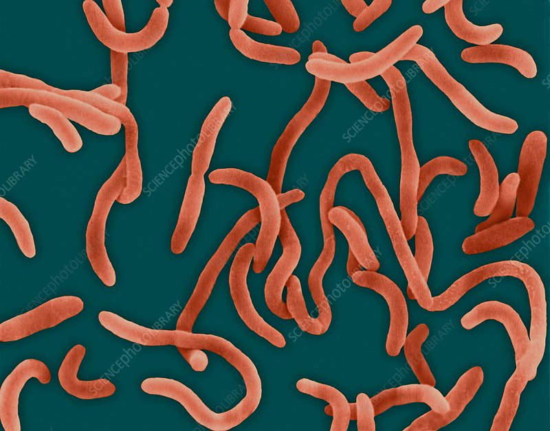 <ul><li><p>cells with curved or twisted rod-like shapes</p></li></ul>