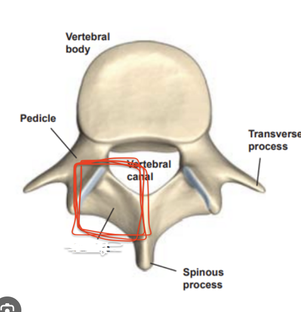 <p>Vertebra Location: (Smooth Surface)</p>