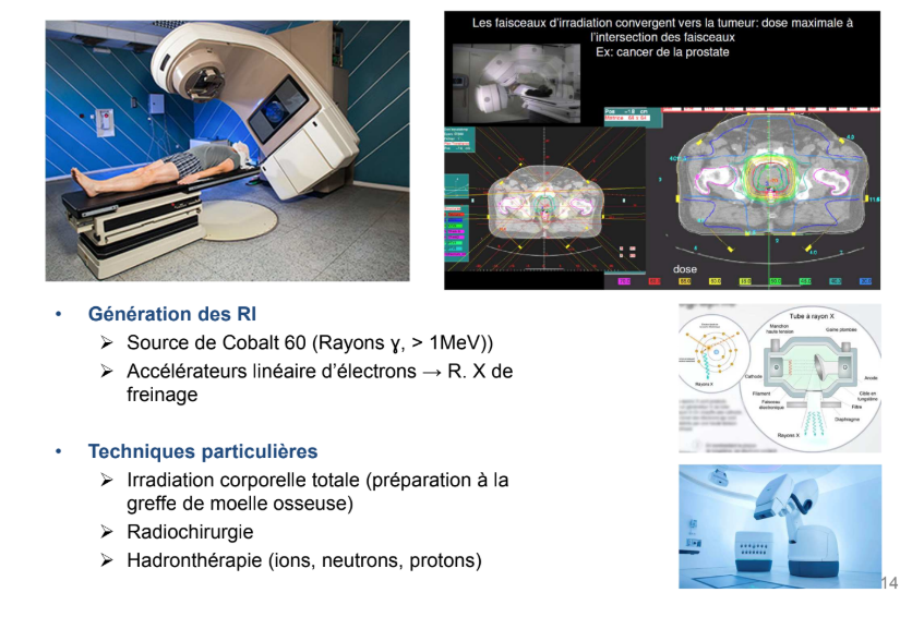 <ul><li><p><u>Techniques particulières de radiothérapie externe :</u></p><ul><li><p><span style="color: red"><strong>Irradiation corporelle totale </strong></span>dans le but de détruire complètement le système immunitaire par exemple en prévention d’une greffe de moelle osseuse.<em> On peut aussi faire ça avec des médicaments : des agents aplasiants</em></p><p></p></li><li><p><span style="color: red"><strong>Radiochirugie</strong></span> avec un cyberknife : c’est un accélérateur linéaire d’électrons très mobile ce qui permet d’avoir des balistiques de traitements optimisées et donc épargner encore plus les tissus environnants</p><p></p></li><li><p><span style="color: red"><strong>Hadronthérapie</strong></span> : Radiothérapie avec des particules (ions, neutrons, protons →protonthérapie = marche très bien notamment sur les tumeurs superficielles (orl…) car ils ont la capacité de déposer bcp d’énergie à un endroit qu’on peut estimer →pic de bragg)</p></li></ul></li></ul><p></p>