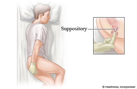 <p>suppository (thuốc đạn)</p>