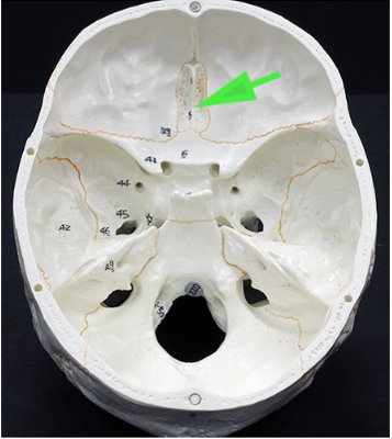 <p>What is the bone marked by the green arrow?</p>