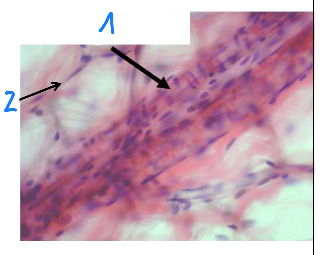 term image
