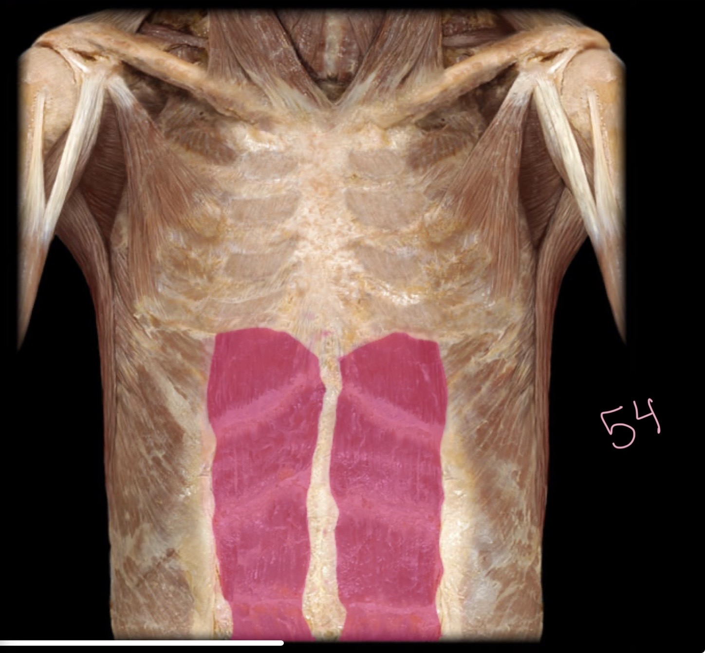 <p>Recuts abdominis</p>