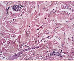 <p>binds the cells and organs of the body together and functions in the protection, support, and integration of all parts of the body</p><ul><li><p>made up of fibroblasts (connective tissue cells)</p></li><li><p>bone, fat, cartilage, blood, padding tissue</p></li></ul><p></p>