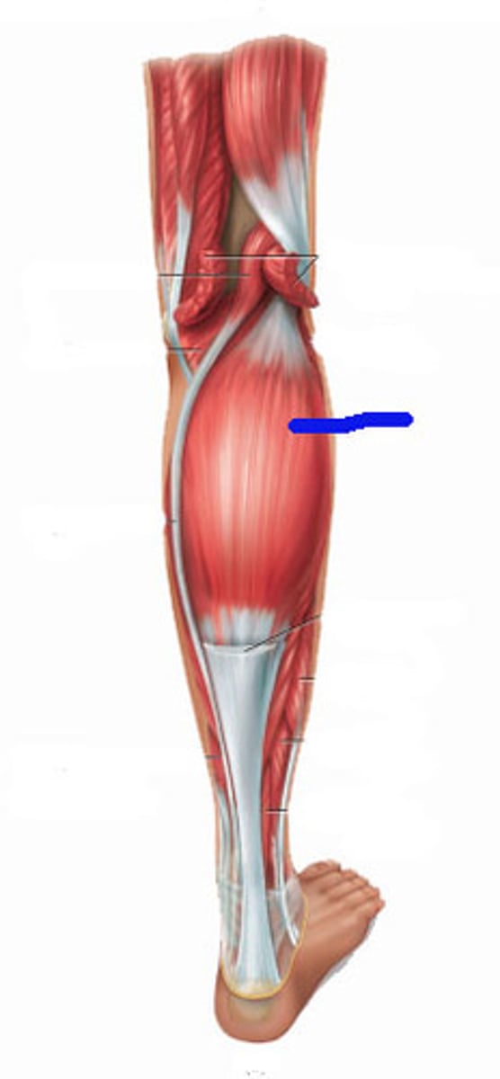 <p>O: posterior aspect of the lateral and medial femoral condyle</p><p>I: calcaneal tuberosity via the achilles tendon</p><p>A: Plantarflexion, knee flexion</p><p>N: tibial</p>