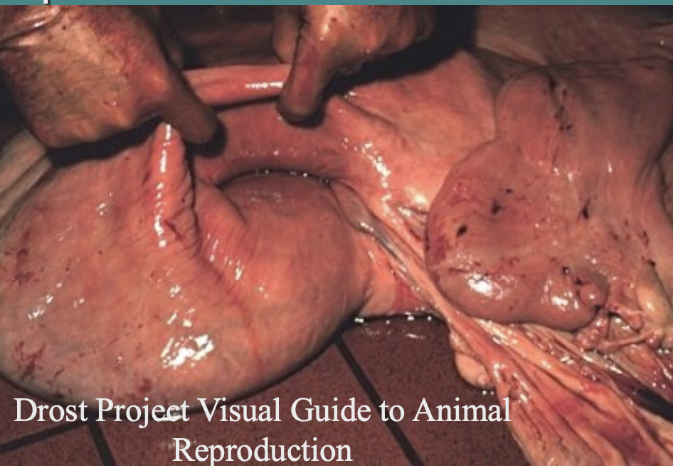 <p>invagination of the uterus may occur and go unnoticed, so should recheck in a day</p>