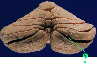 <p><span><span>Identify the indicated groove of the cerebellum.</span></span></p>