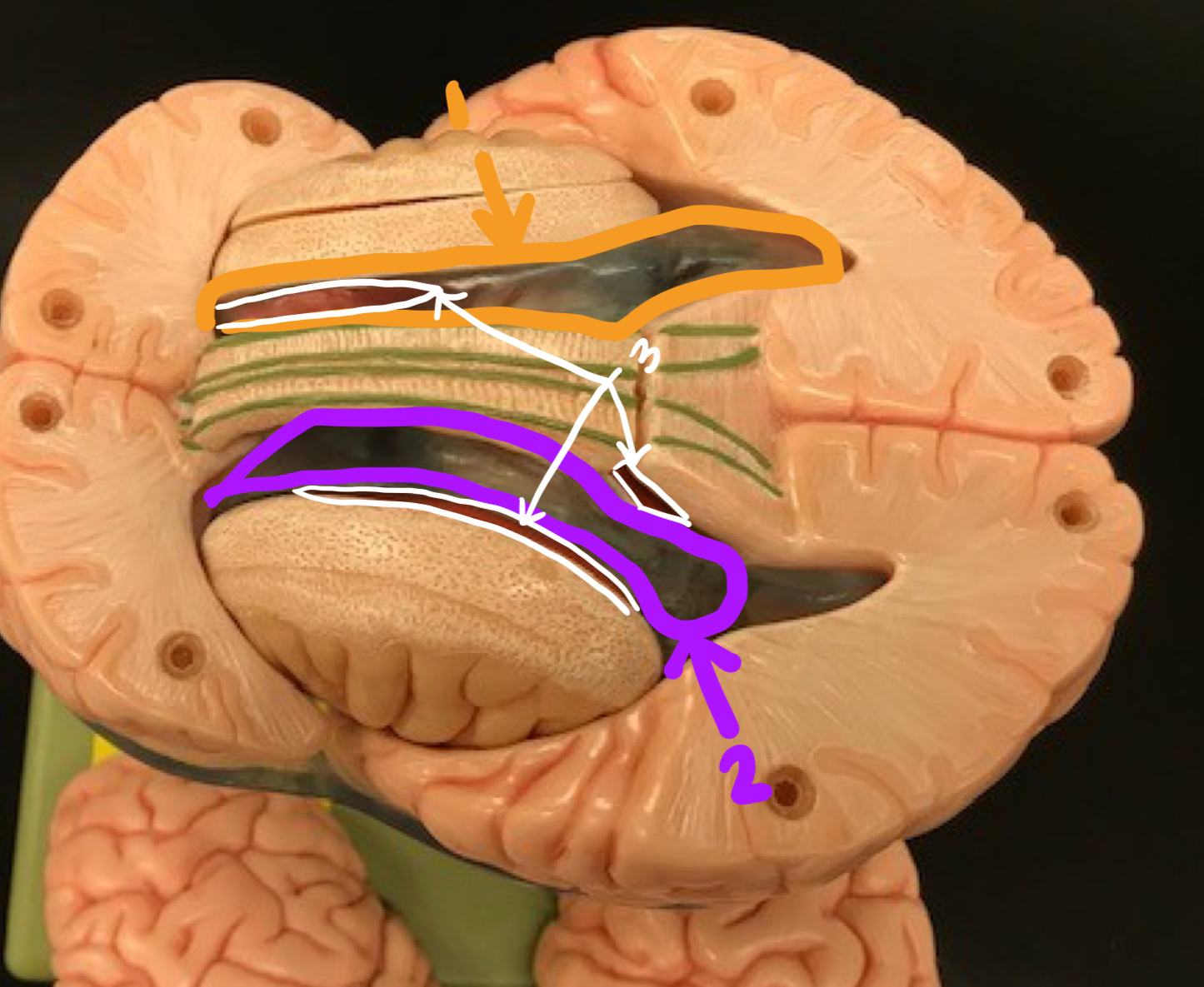 <p><strong>open spaces of the brain + the spine</strong></p><p>what structure is at 1/2/3?</p>