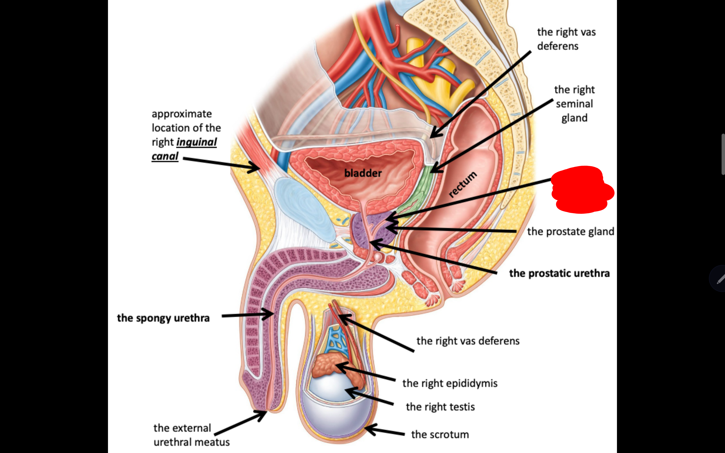 <p>Name the structure in red</p>