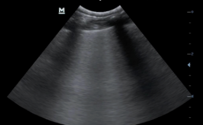 <p>What are these lines?</p>