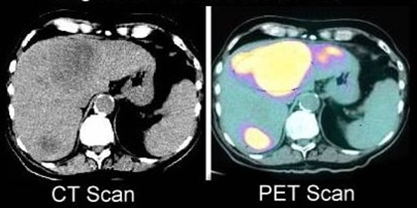 <p>get a medical test that analyses your body tissues</p>