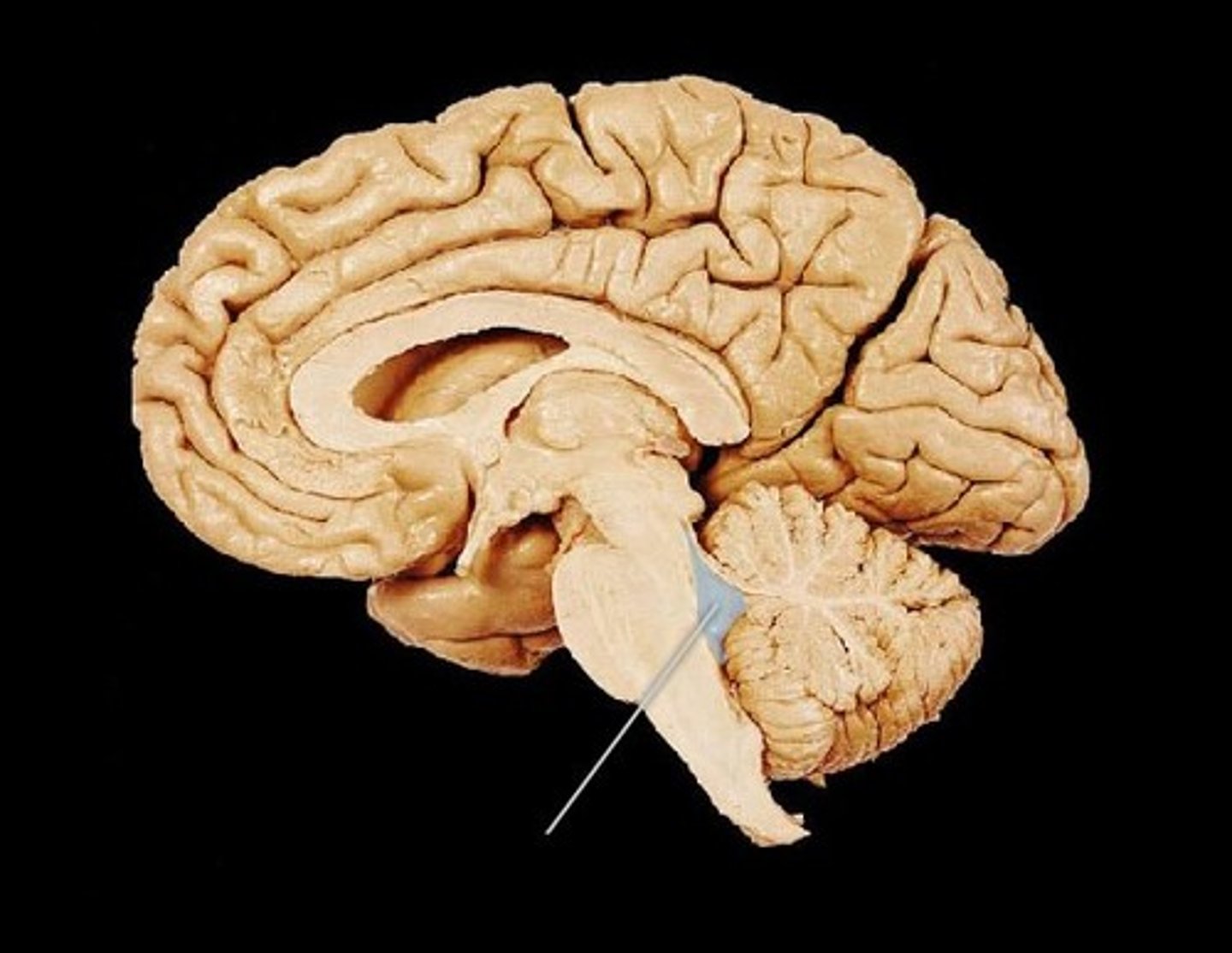 <p>pyramid-shaped in posterior part of pons and medulla; continues into cervical region of the spinal cord as central canal of spinal cord where CSF travels into subarachnoid space</p>
