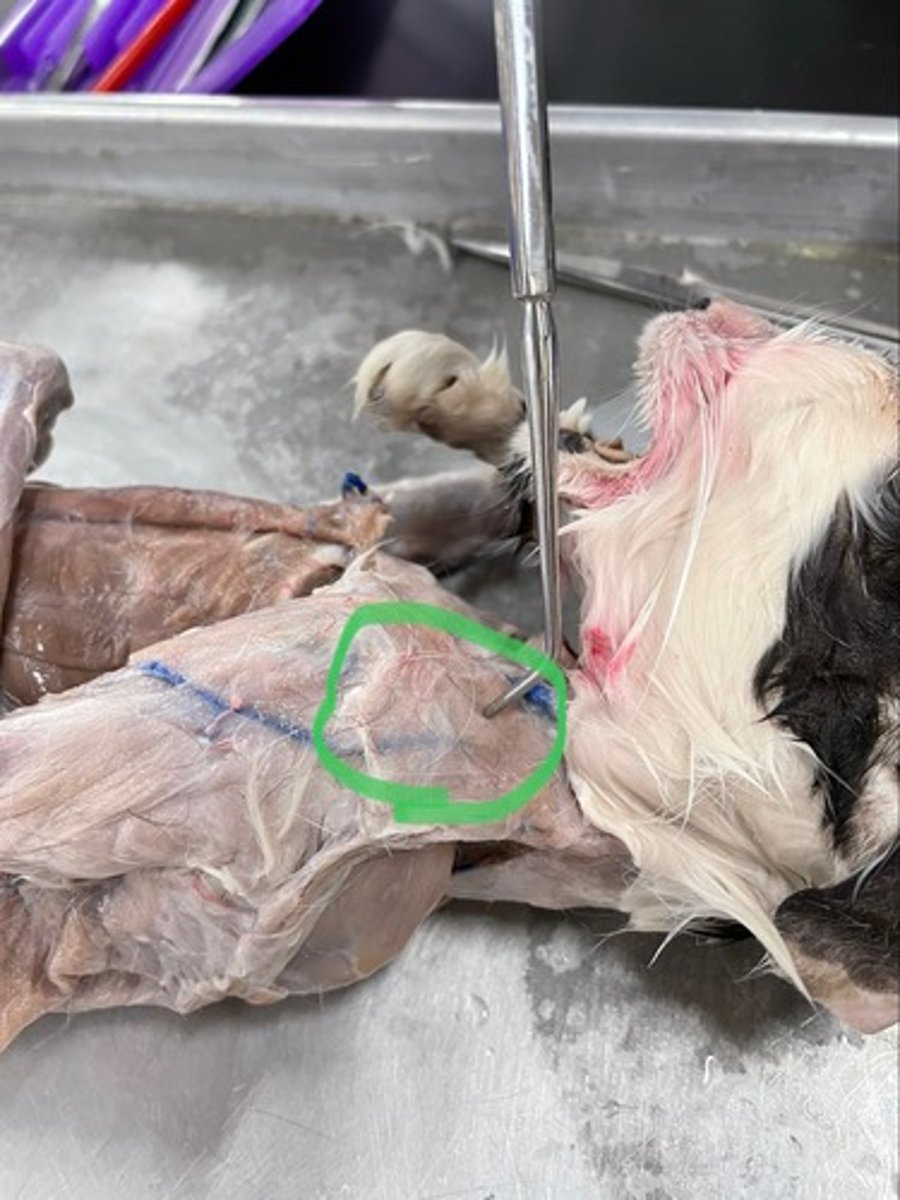 <p>O: spine of scapula</p><p>I: deltoid tuberosity of humerus</p><p>A: abducts shoulder</p>