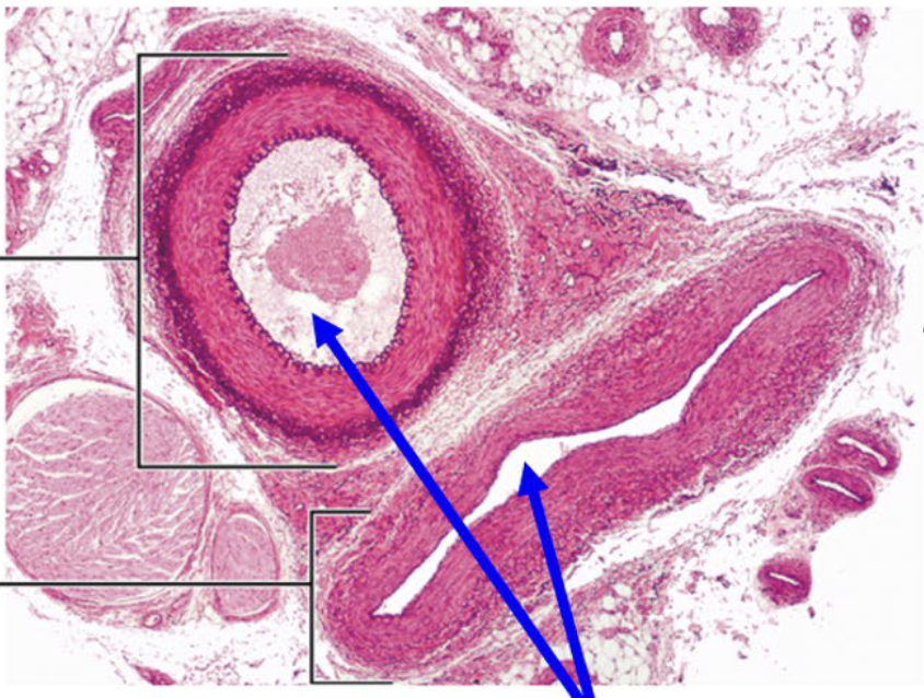 <p>What is the arrow point at?</p>