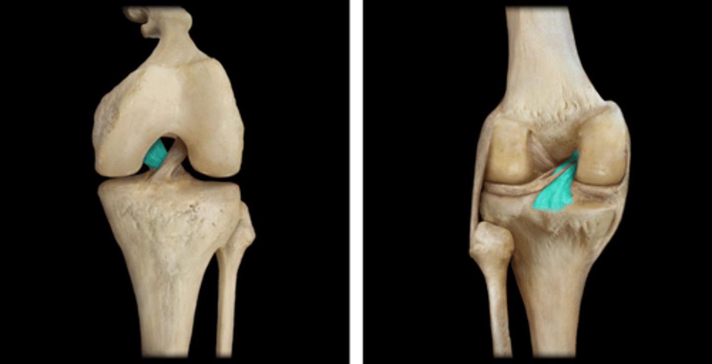 <p>Name this connective tissue structure.</p>