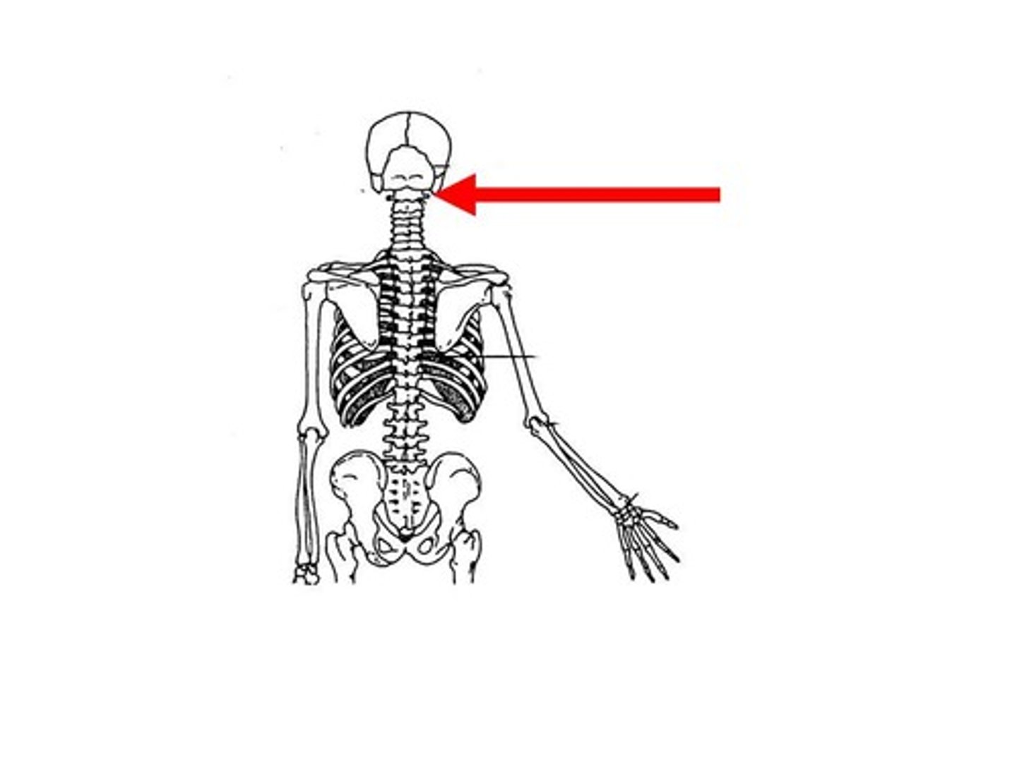 <p>the joint axis is parallel to the long axis of the bones (atlantoaxial joint)</p>