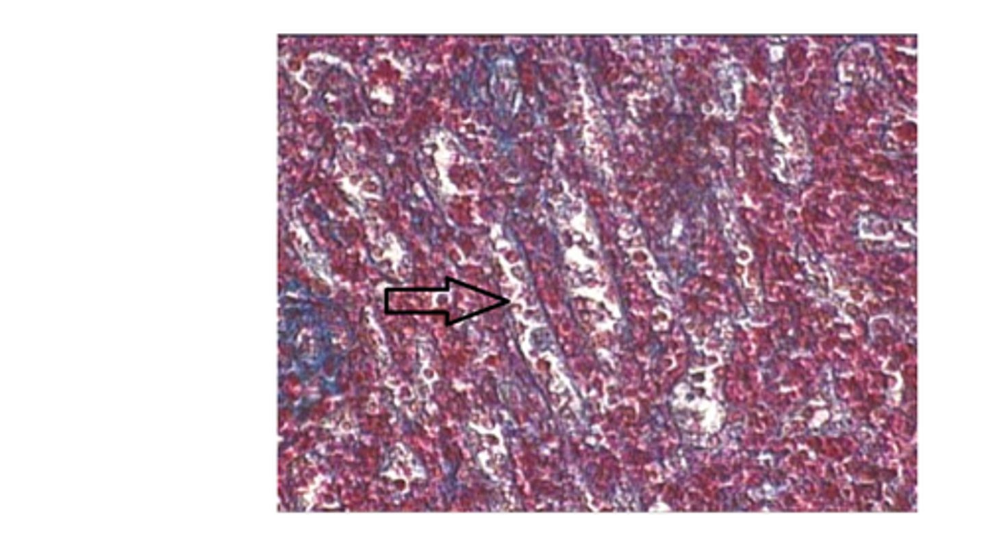 <p>Identify the structure at the arrow?</p><p>Sinusoidal capillary of the spleen</p>