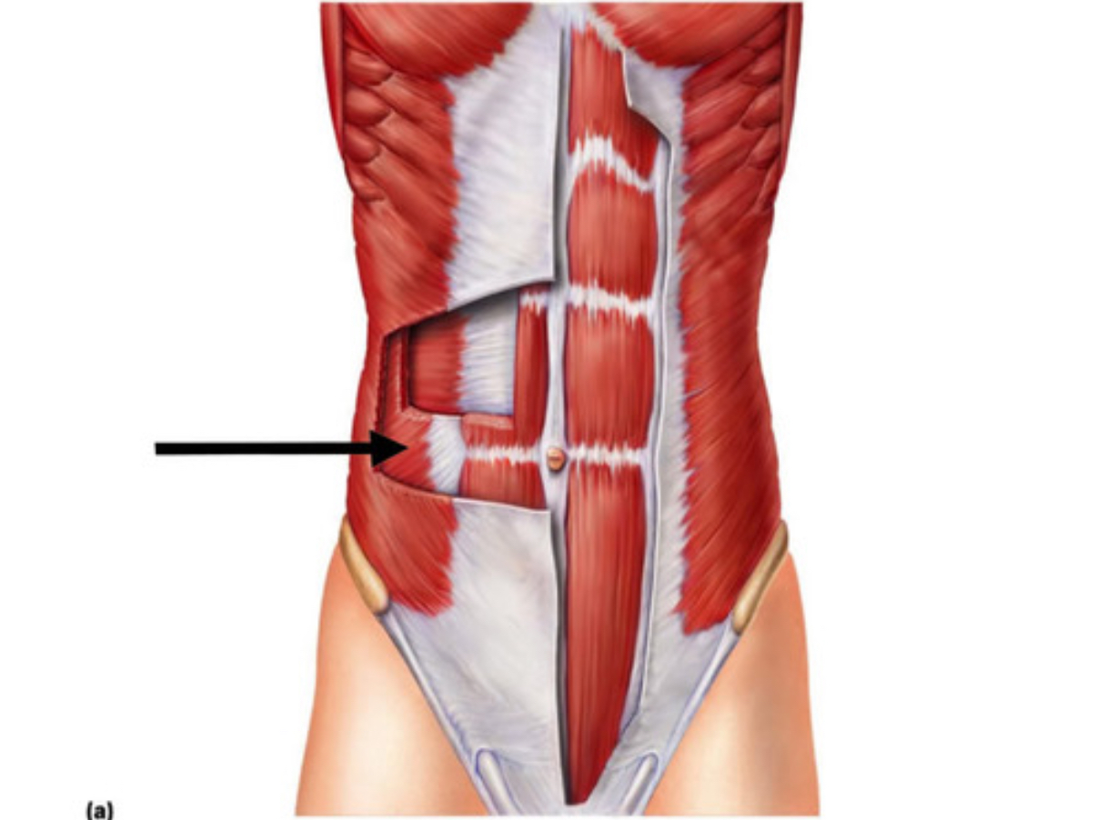 <p>what muscle is this?</p>