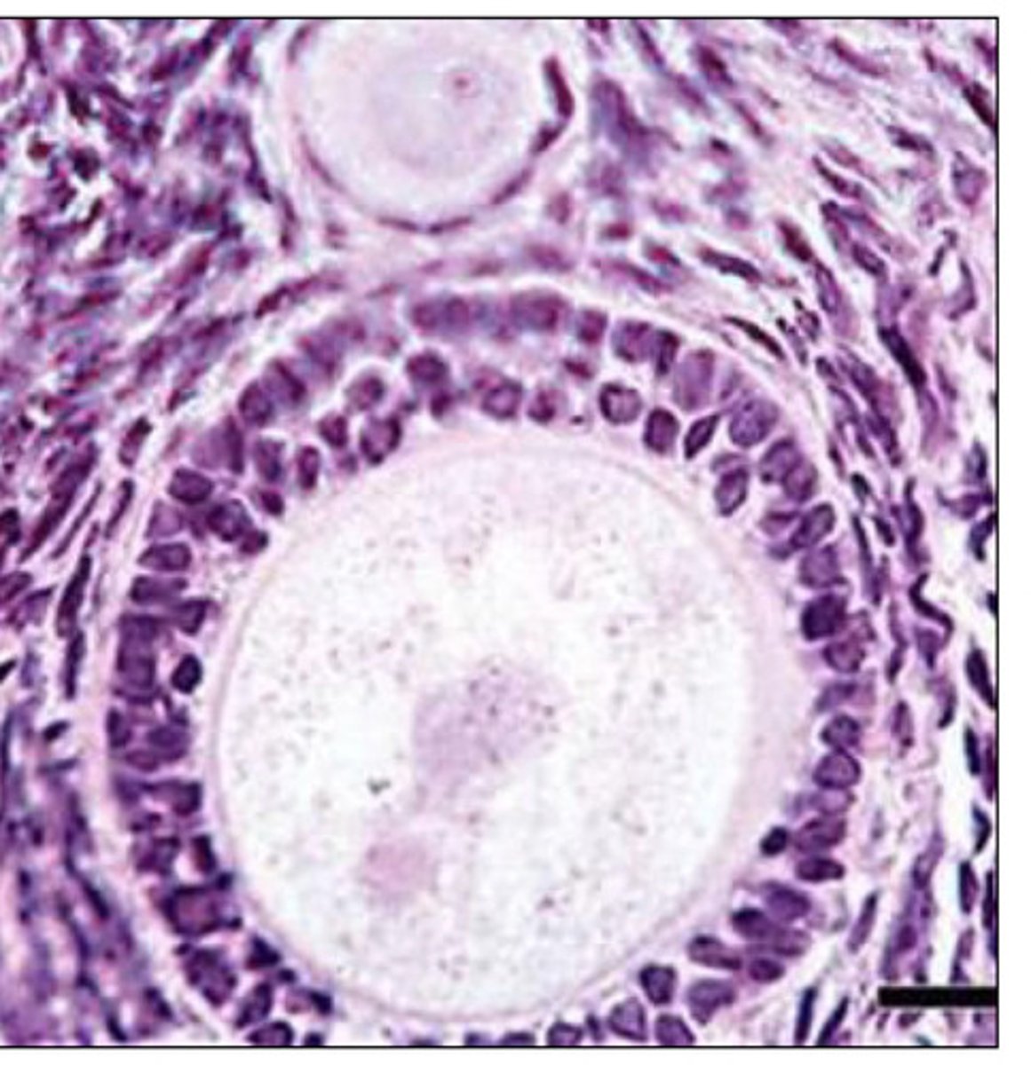 <p>what type of follicle?</p>