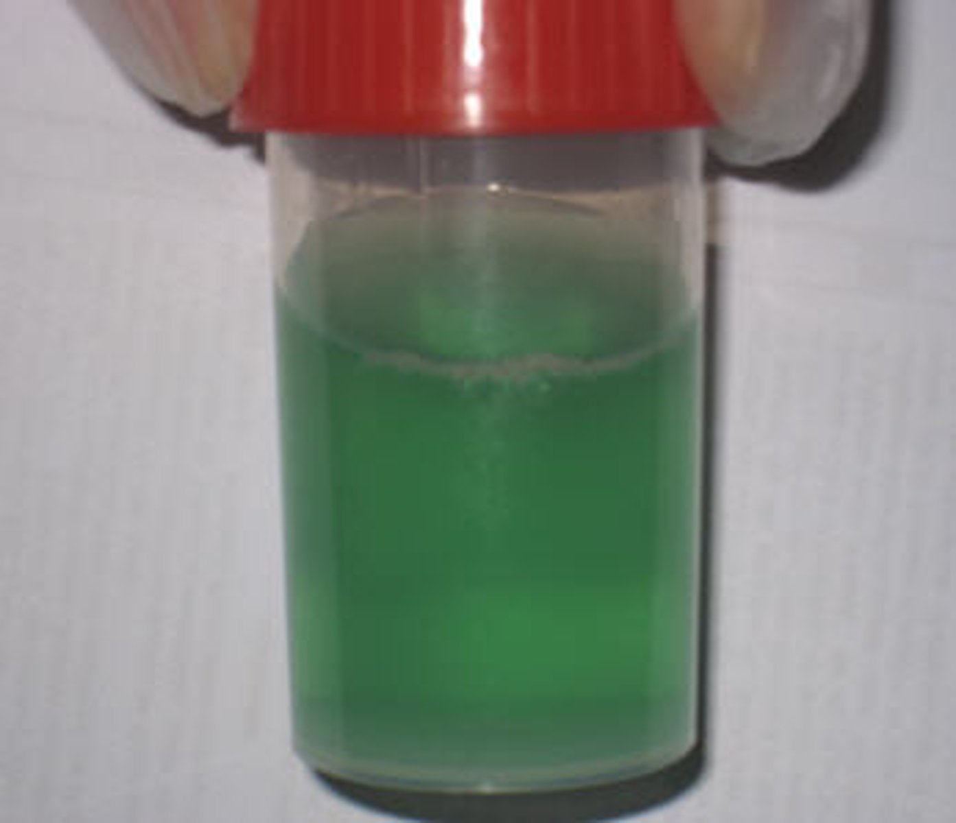 <p>glucose aka sugar in your urine</p>