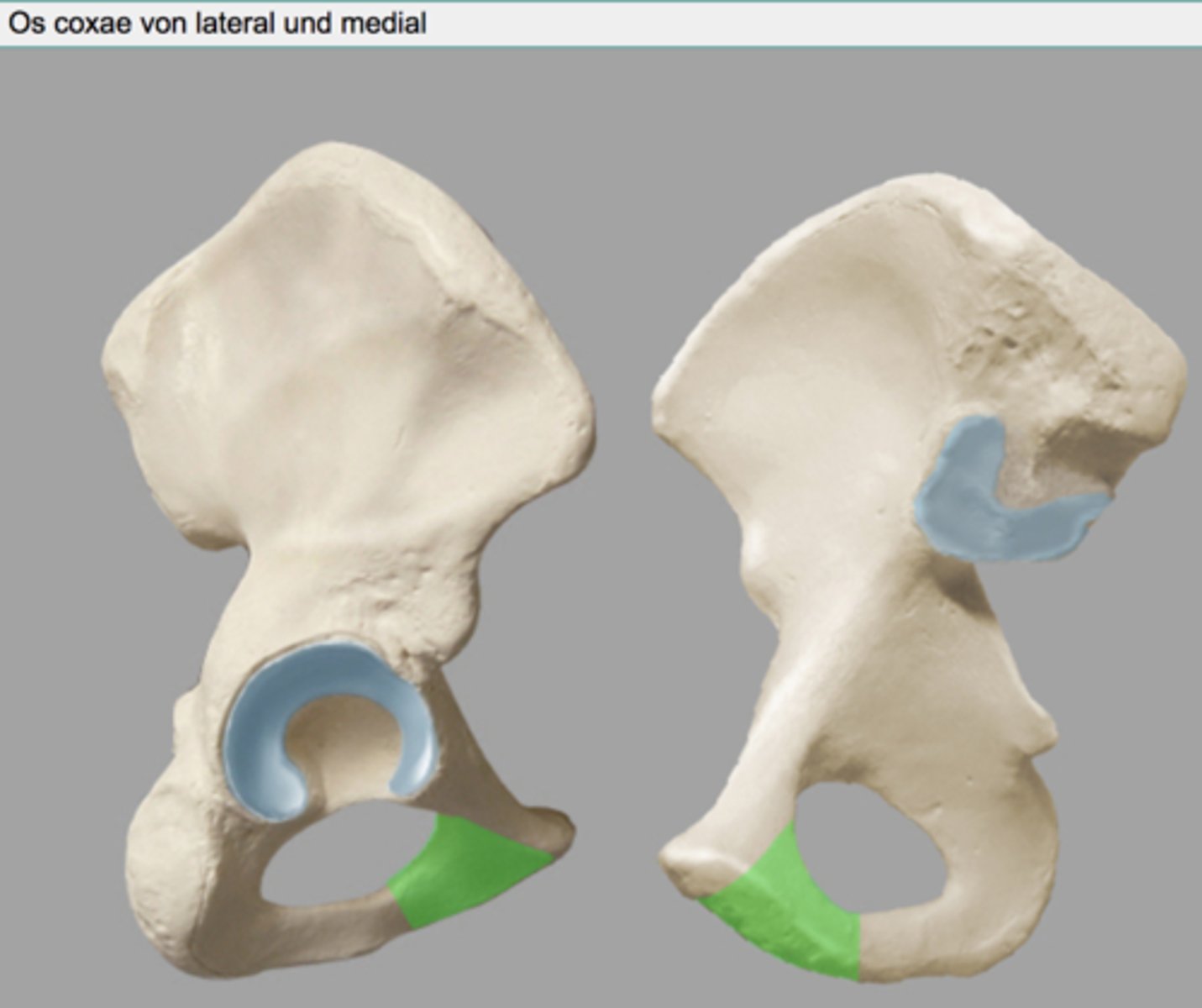 <p>ramus inferior ossis pubis</p>