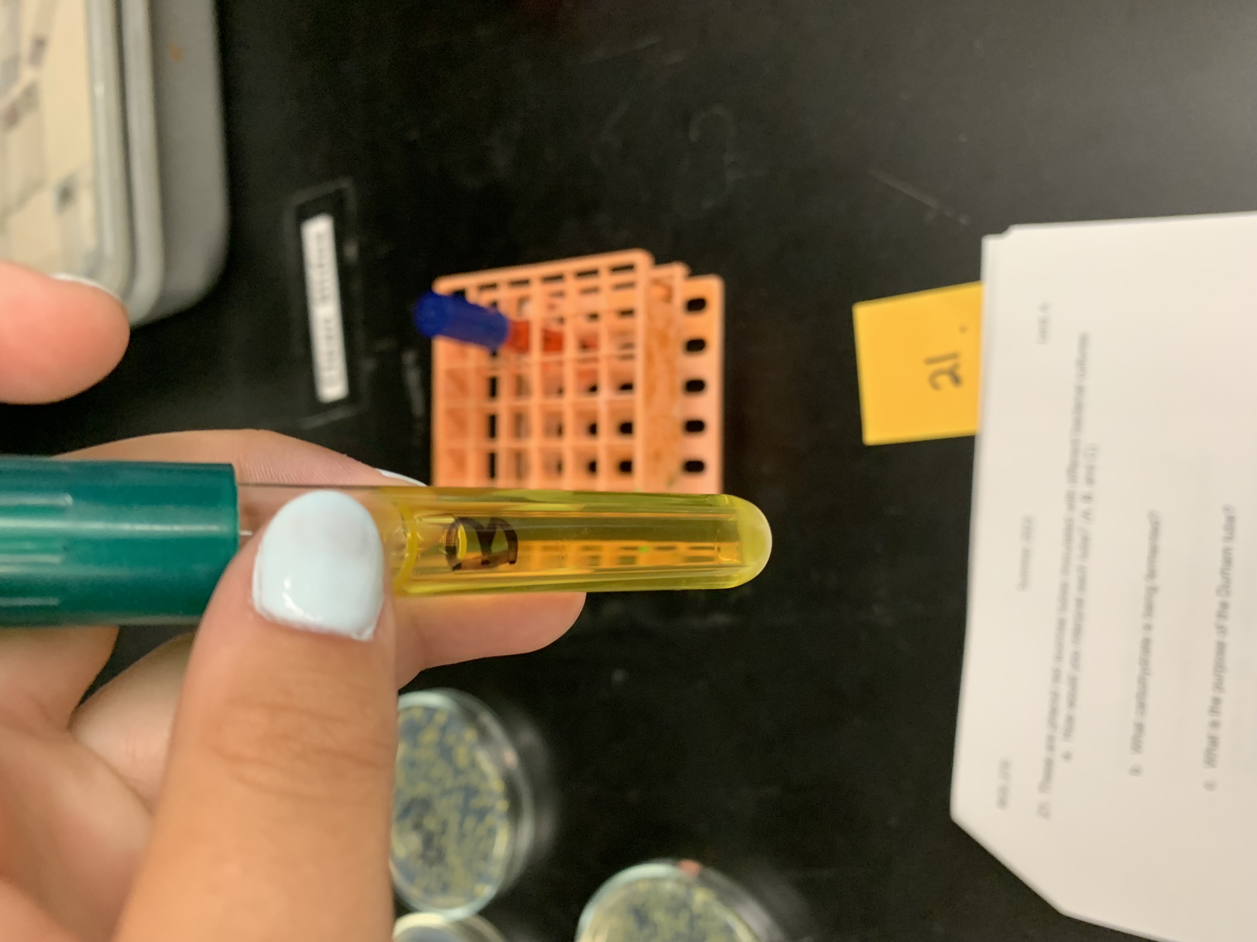 <p>(Phenol red sucrose tube) interpret the tube</p>