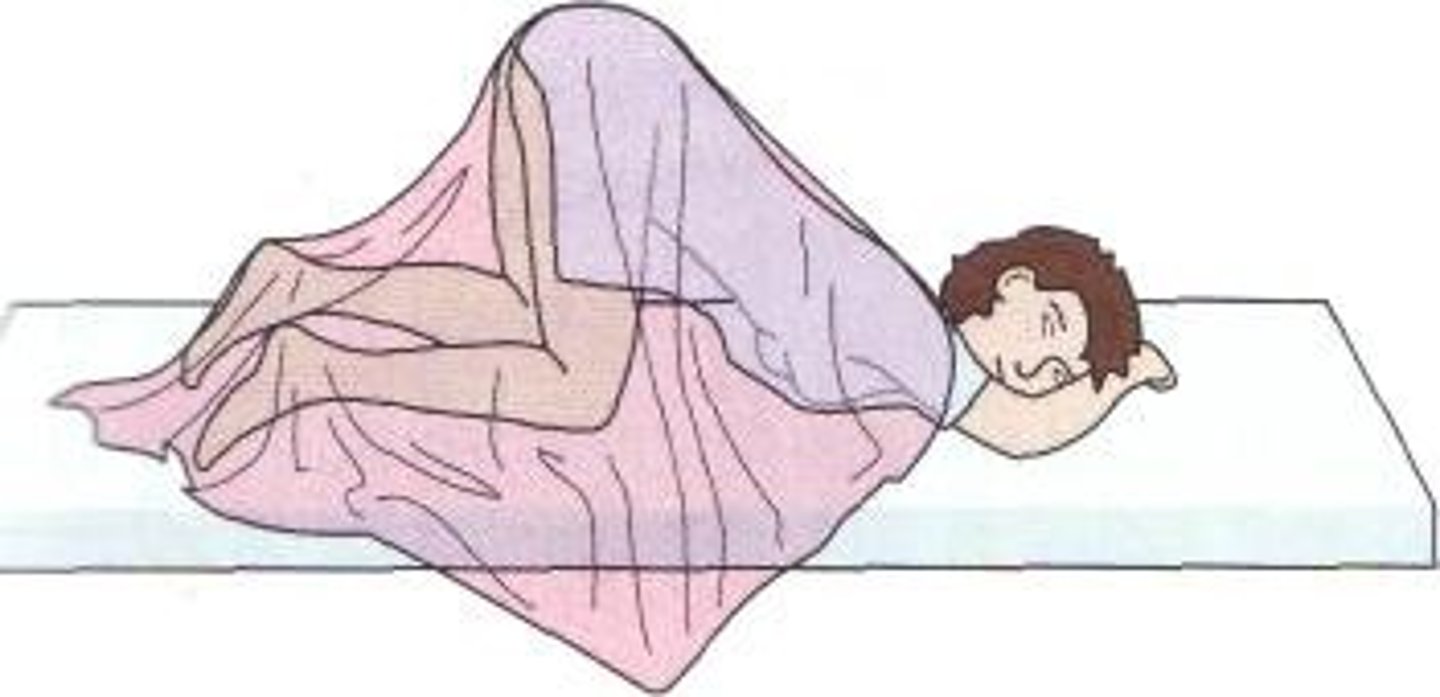 <p>patient rests body weight on knees &amp; chest; used for sigmoidoscope &amp; rectal exams</p>