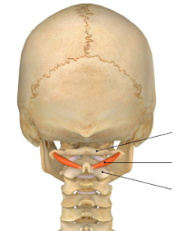 <p>Origin: Apex of the spinous process of the axis (C02)</p><p>Insertion: Interior and dorsal part of the transverse process of the atlas (C01)</p><p>Innervation: Posterior primary division of the spinal nerves (suboccipital)</p><p>Action: Ipsilateral rotation of the head; extension and lateral flexion of spine + neck</p>